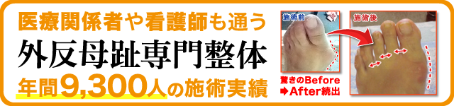 外反母趾専門センター