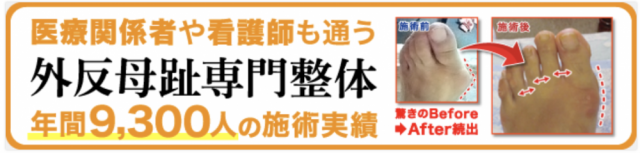 外反母趾専門整体